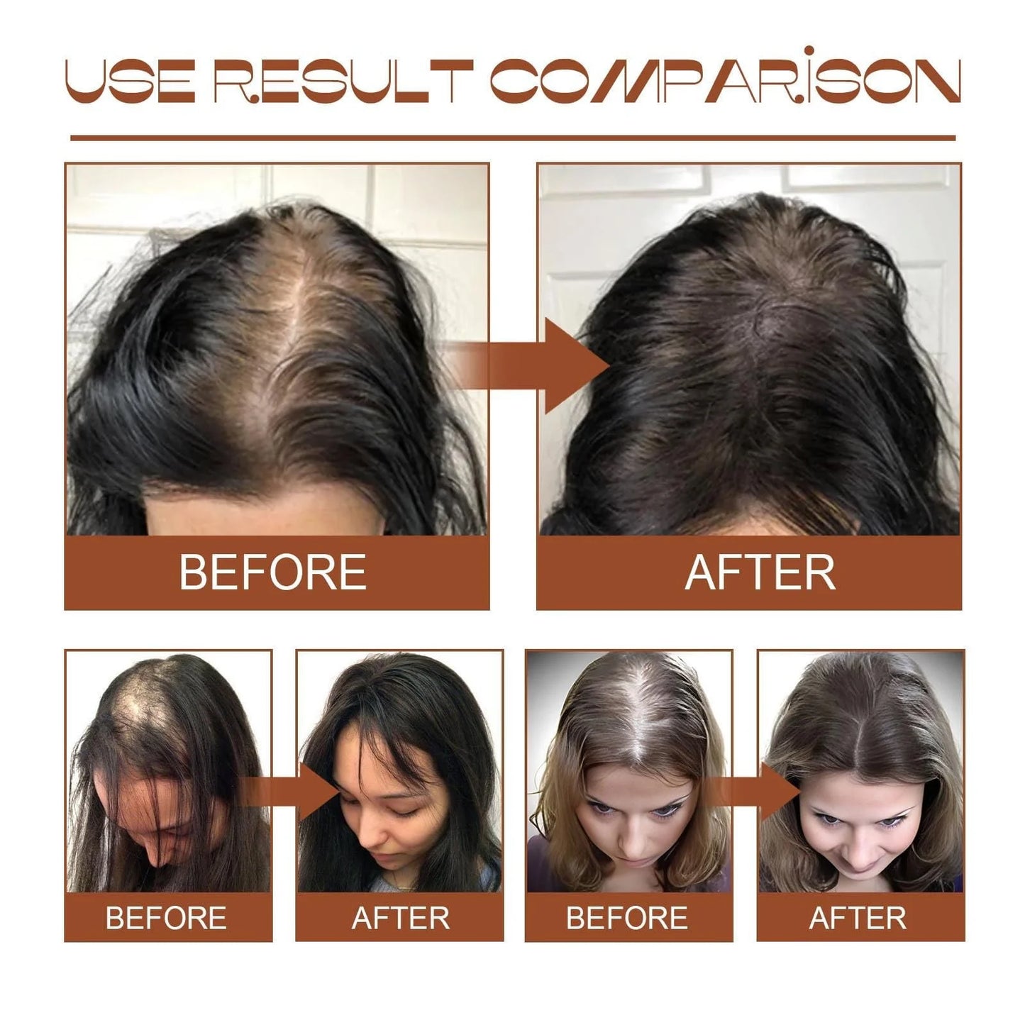 Batana Oil for Hair Growth Healthier Thicker Fuller Hair Batana Oil Batana Oil Batana Oil 120G (1Pcs)