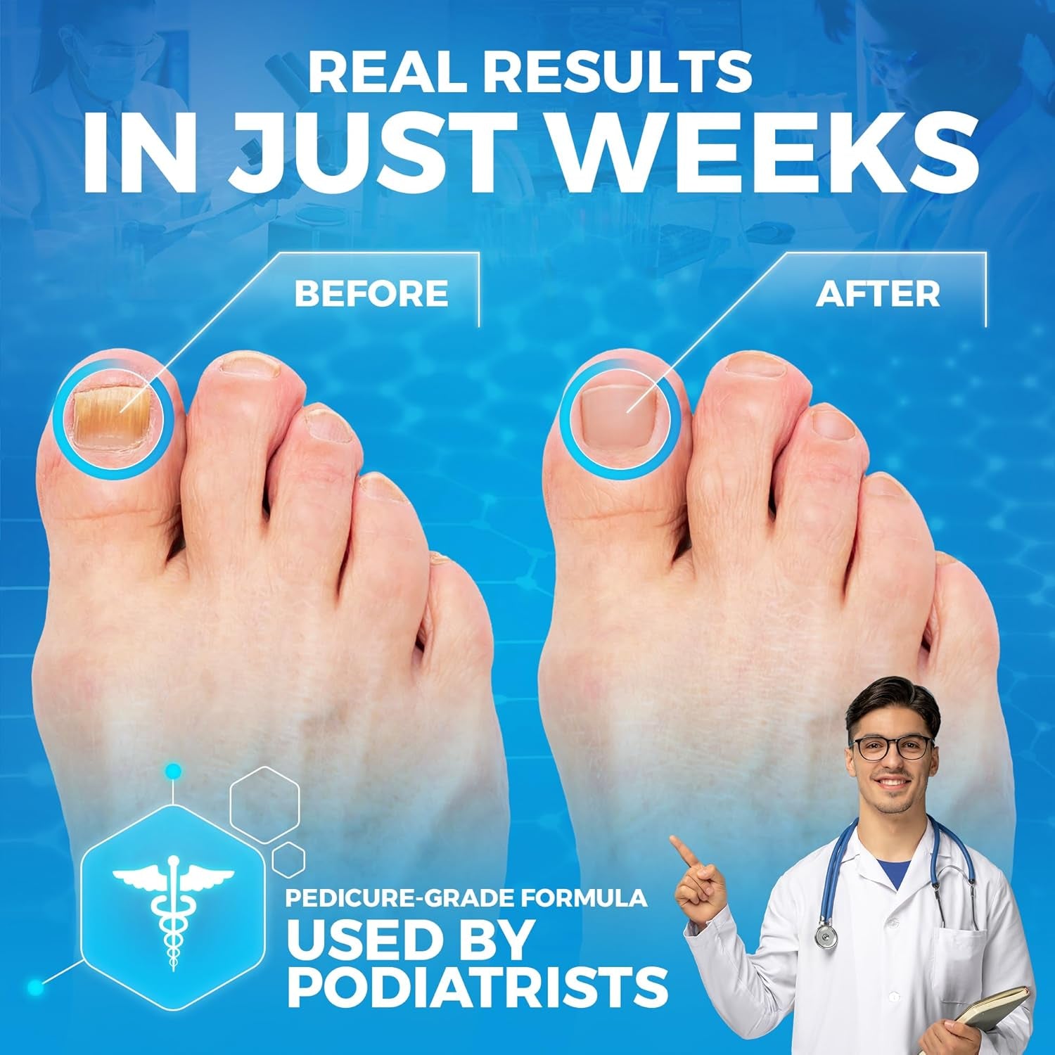 Epsom Salt Foot Soak W Tea Tree for Foot Bath (PEDICURE GRADE) - Toenail Repair, and Fungus Athletes Foot, Softens Calluses, Tired Feet, Nail Discoloration Foot Soak Salts, Smelly Foot Therapy16Oz