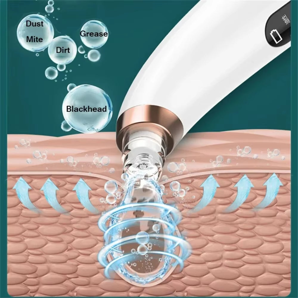 Electric Small Bubble Blackhead Remover USB Water Cycle Pore Acne Pimple Removal Vacuum Suction Facial Nose Cleaner Tool